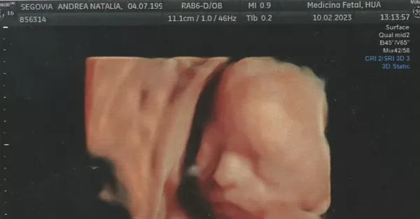 Fray Luis Beltrán: piden ayuda para una bebé por nacer que debe someterse a una cirugía fetal